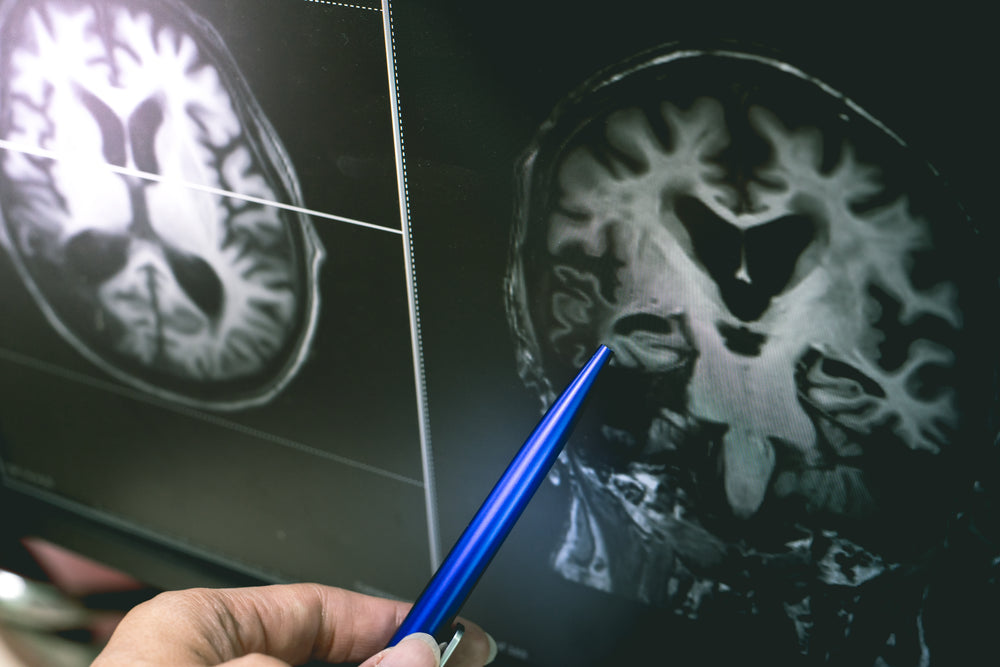 Clinician reviewing brain MRI imaging